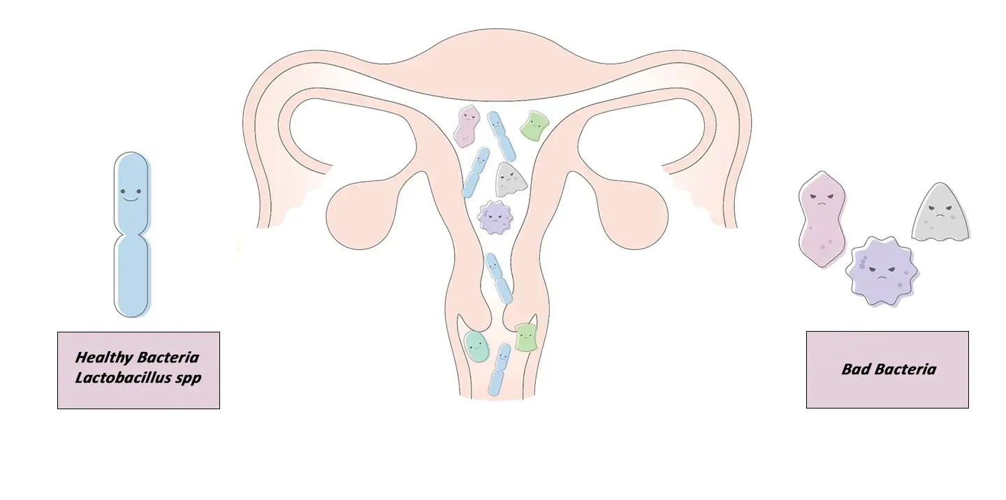 Endometrial Microbiome Test
